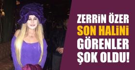 ZERRİN ÖZER ESTETİK İLE SANKİ BAŞKA BİRİ GİBİ...